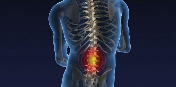 Back pain with low back pain