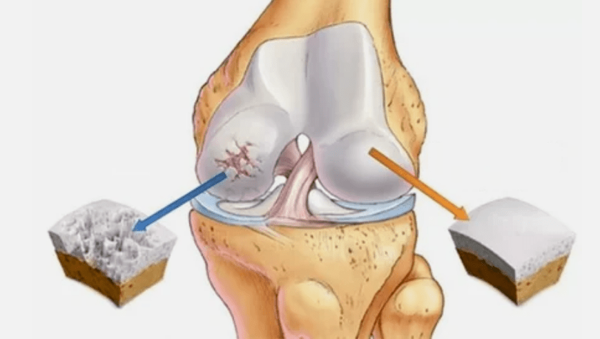 How joints develop