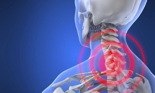 Causes of cervical osteochondrosis