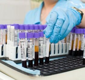 Blood test to diagnose joint pain