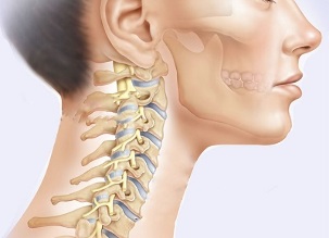 What are the symptoms of cervical osteochondrosis