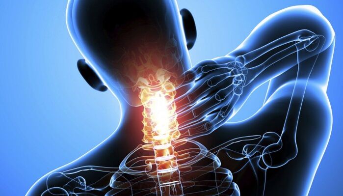 cervical pain
